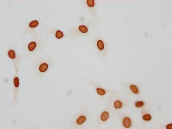 100UL ACETYL-HISTONE H1.1 (LYS21) AN 100
