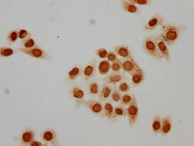 100UL ACETYL-HISTONE H1.2 (LYS89) AN 100