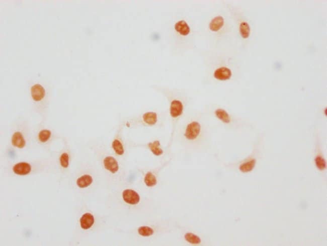 100UL ACETYL-HISTONE H1.4 (LYS45) AN 100