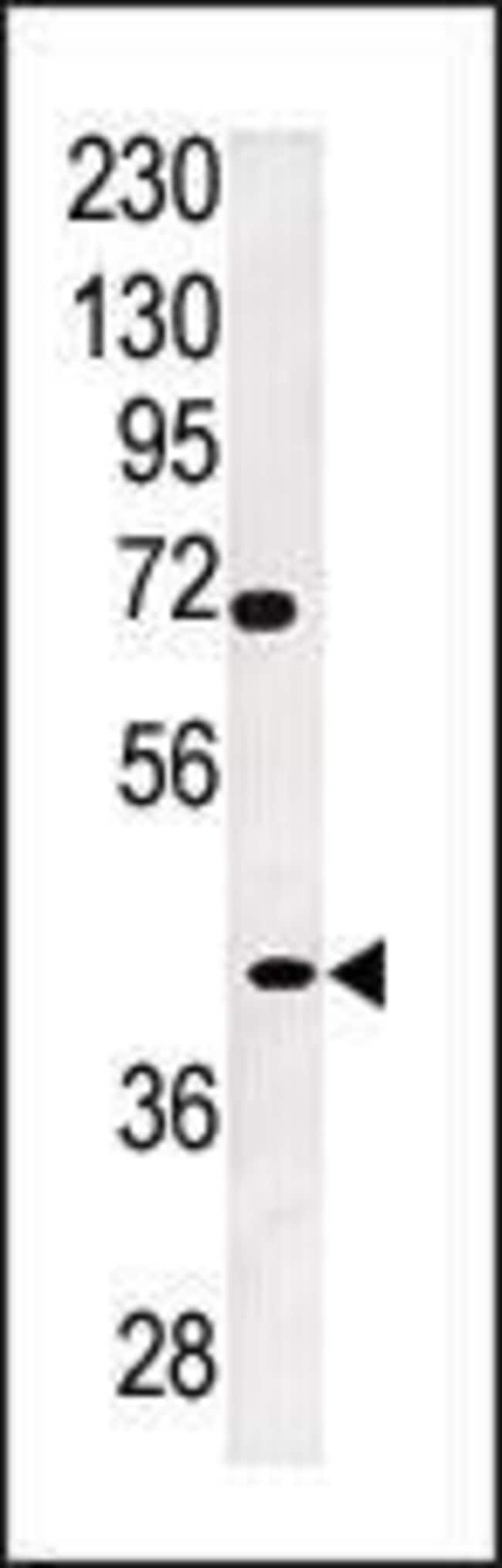 ANTI-TPST2, 0,1mg .
