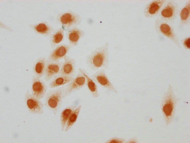 100UL ACETYL-HIST1H2AG (LYS15) ANTIB 100