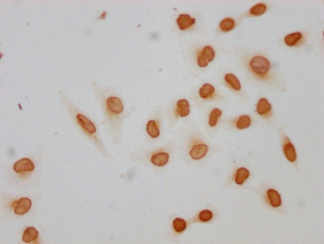 100UL ACETYL-HIST1H2AG (LYS9) ANTIBO 100