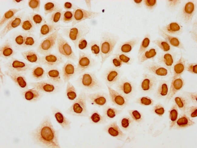 100UL ACETYL-HIST1H2BC (LYS20) ANTIB 100