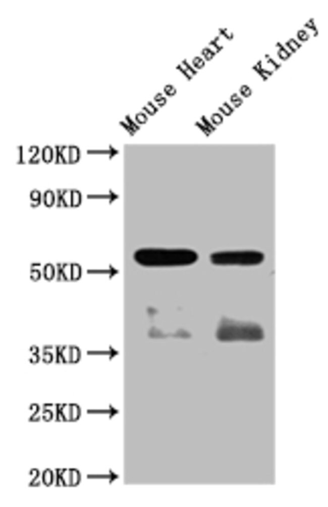 100UL ANGIOPOIETIN 4 ANTIBODY 100UL
