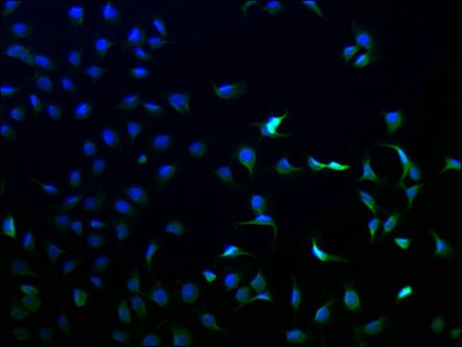 100UL ANKEF1 ANTIBODY 100UL