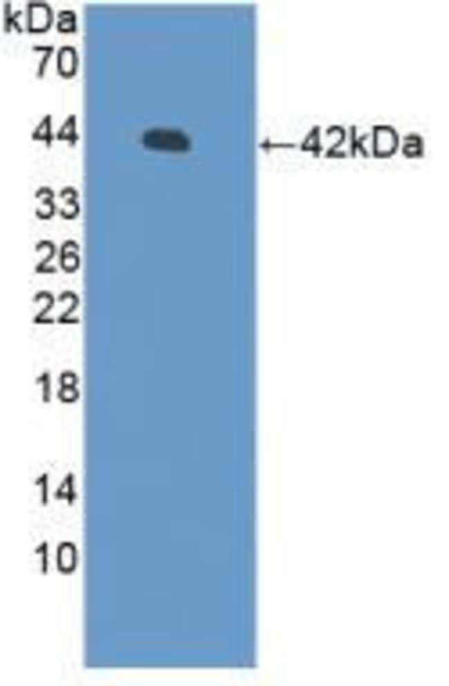 100UL BETA-DEFENSIN 126 ANTIBODY 100UL