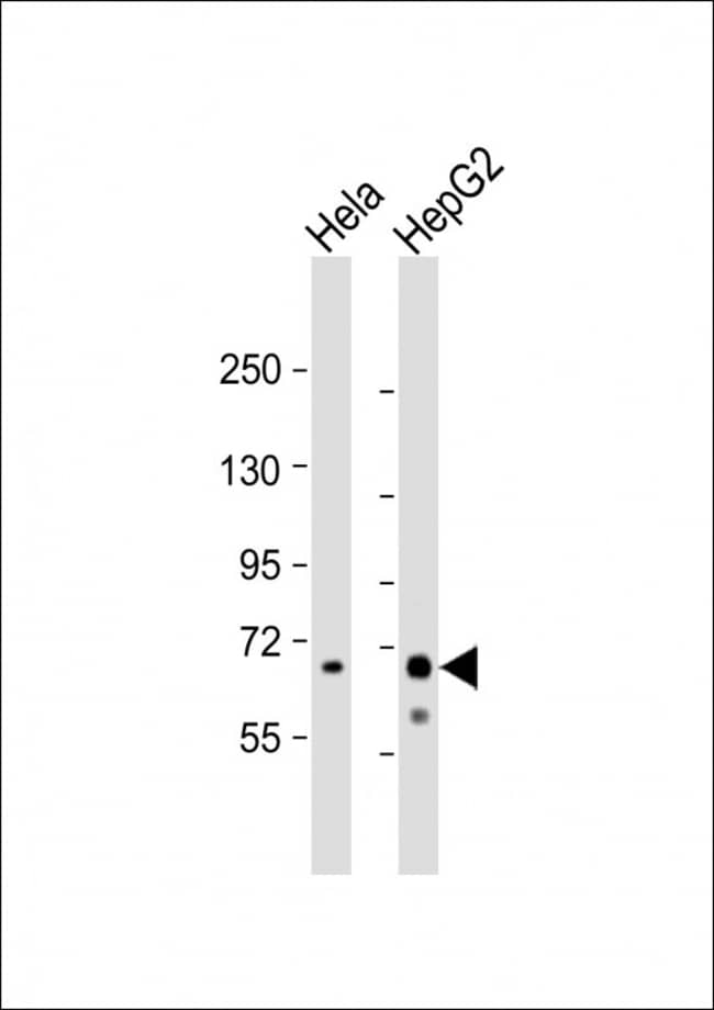ANTI-RIBOPHORIN, 0,1mg .