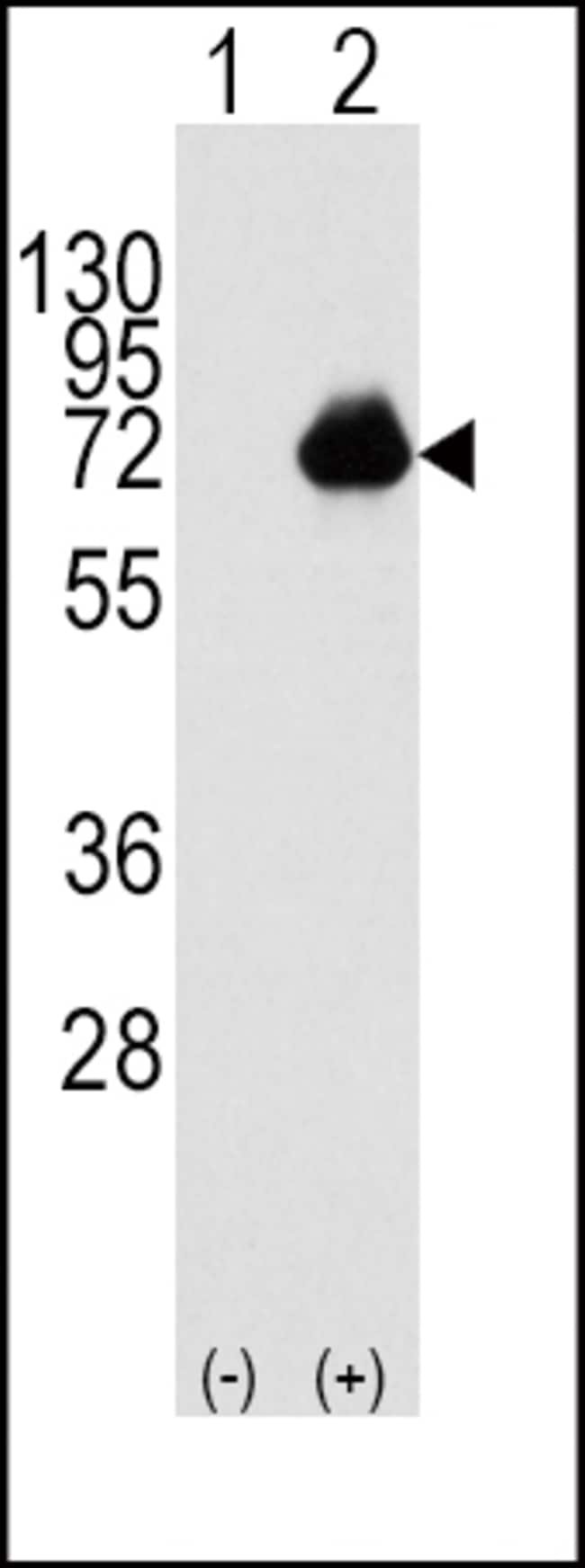 ANTI-ACOX1, 0,1 MG