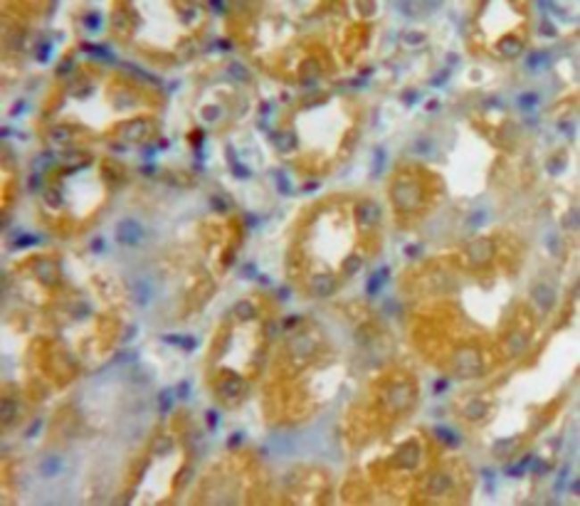 100UL BETA-3 DEFENSIN ANTIBODY 100UL