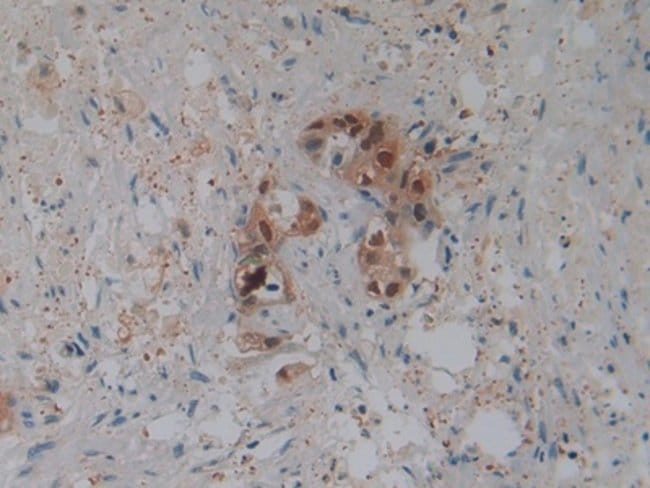 100UL BETA-2 DEFENSIN ANTIBODY 100UL