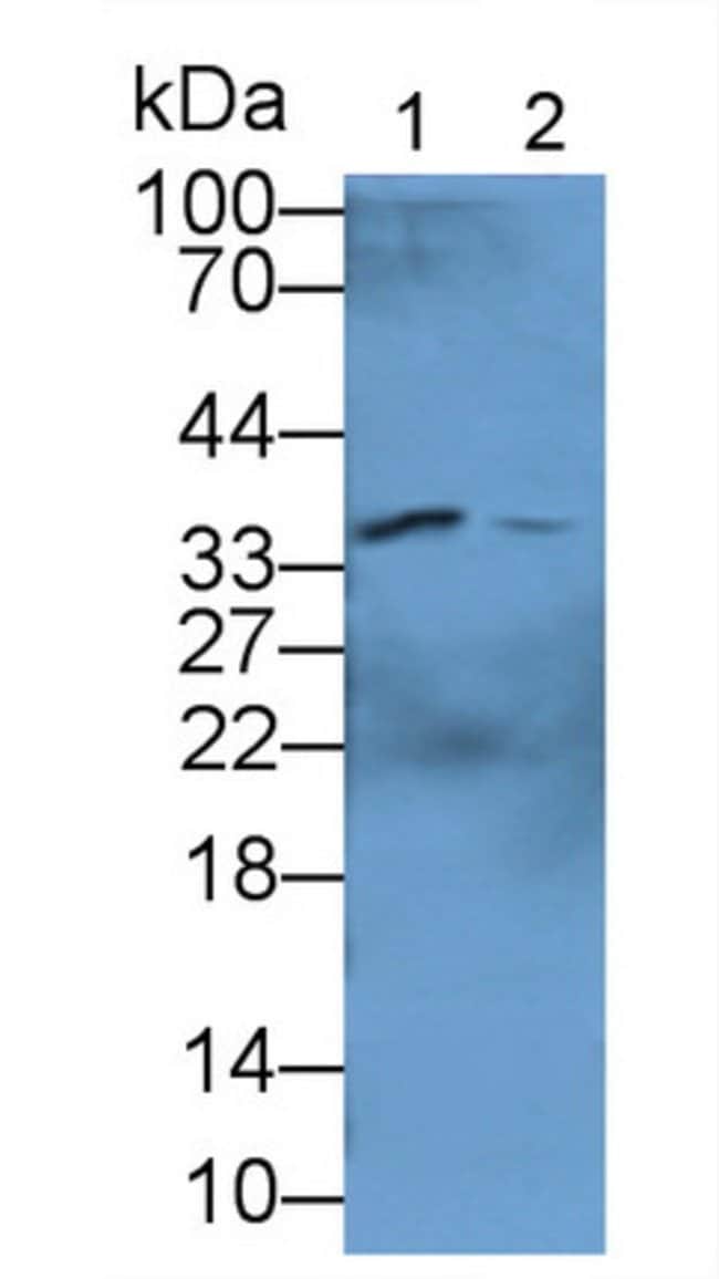 100UL BETA L CRYSTALLIN ANTIBODY 100UL