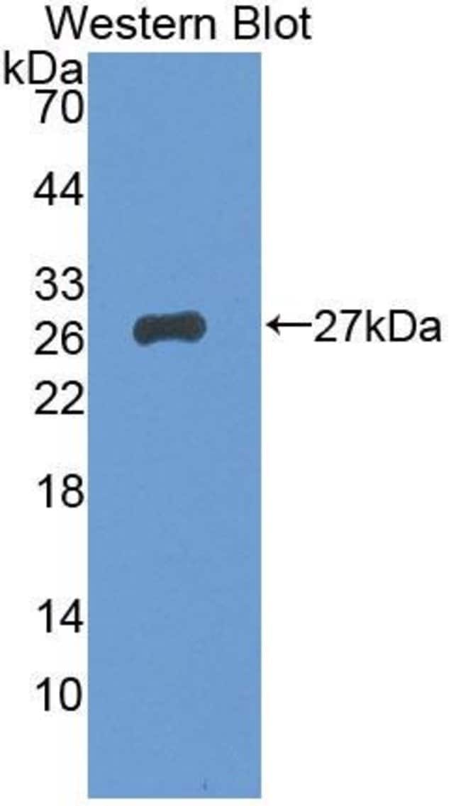 100UL BCMO1 ANTIBODY 100UL