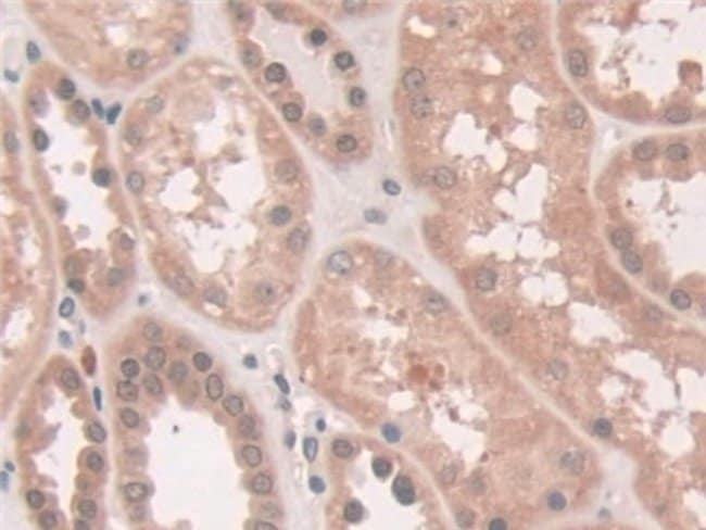 100UL ATP7B ANTIBODY 100UL