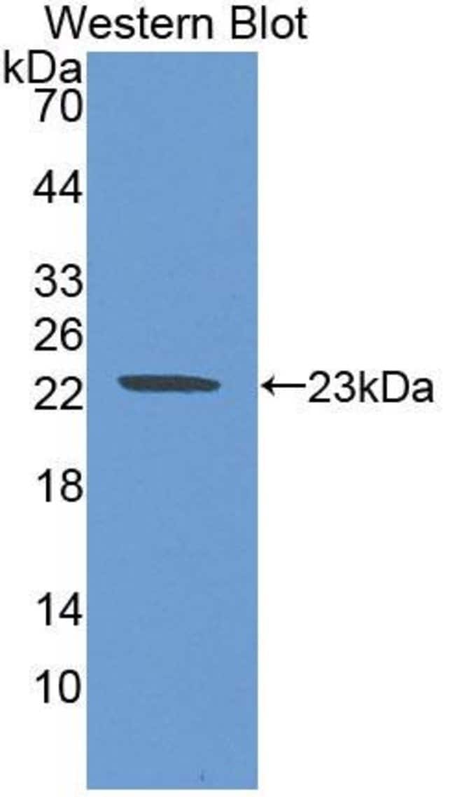 100UL ASAM ANTIBODY 100UL