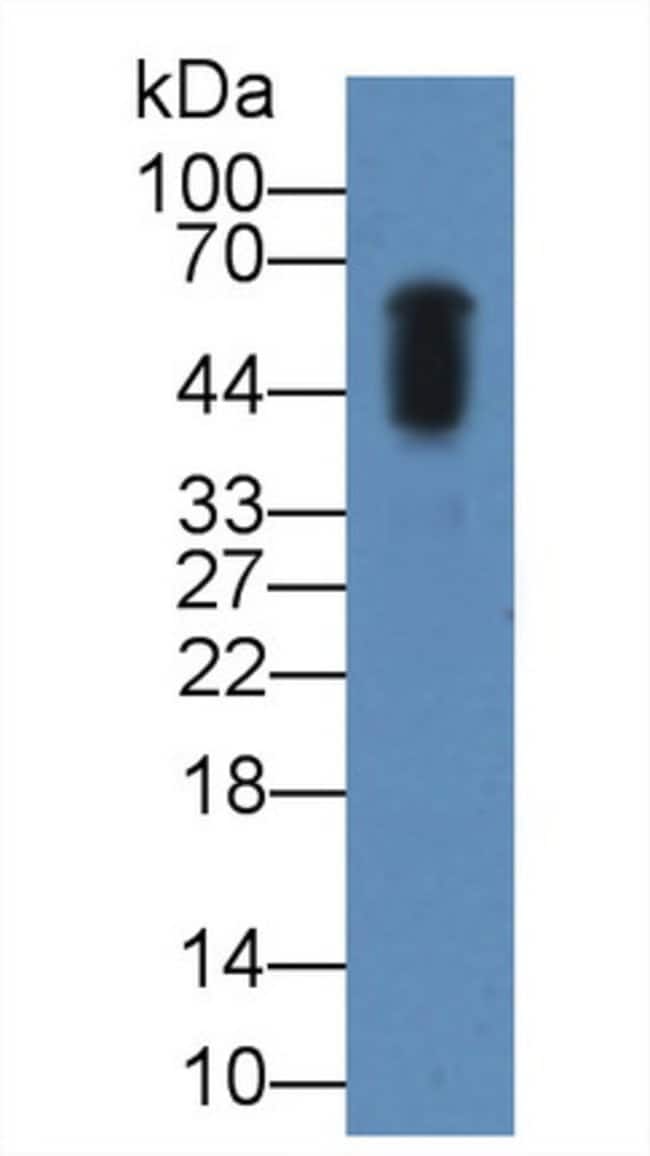 100UL AMYLASE ALPHA ANTIBODY 100UL