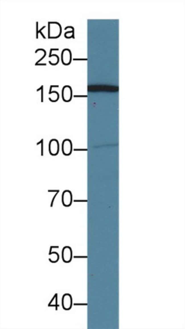 100UL AIM1 ANTIBODY 100UL