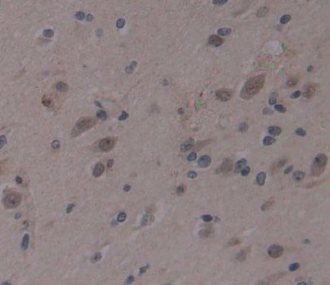 100UL AHRR ANTIBODY 100UL