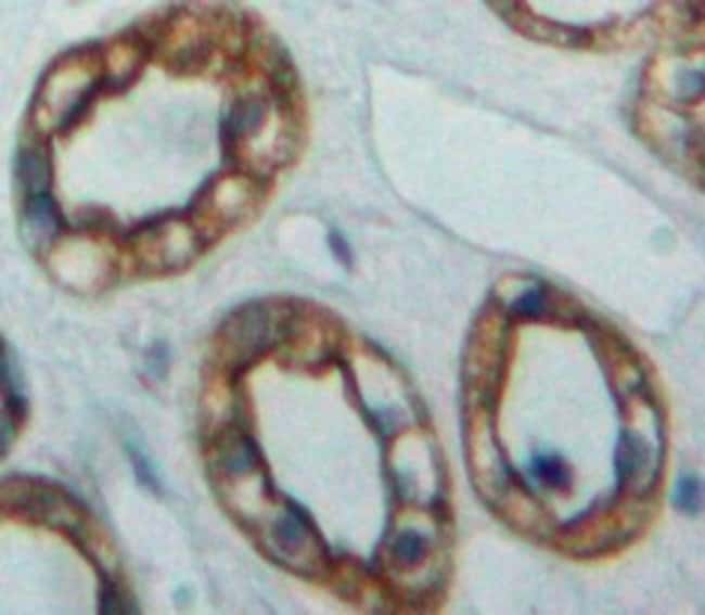 100UL ADENYLATE CYCLASE 5 ANTIBODY 100UL