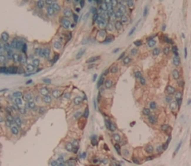 100UL ADAMTS16 ANTIBODY 100UL
