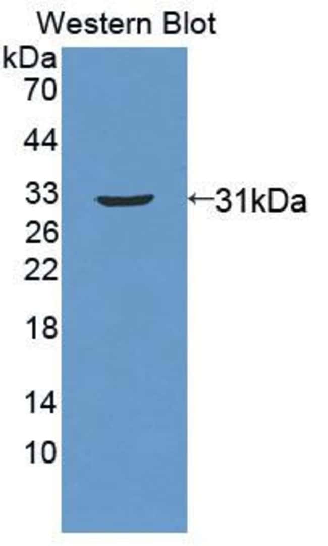 100UL ABCC11 ANTIBODY 100UL