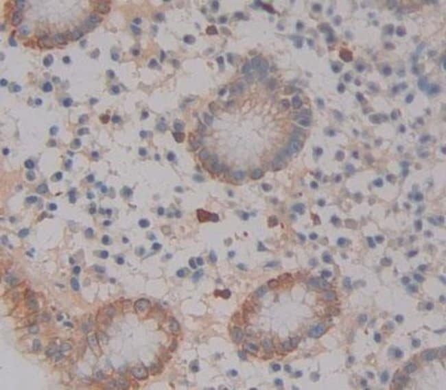 100UL ABCA12 ANTIBODY 100UL