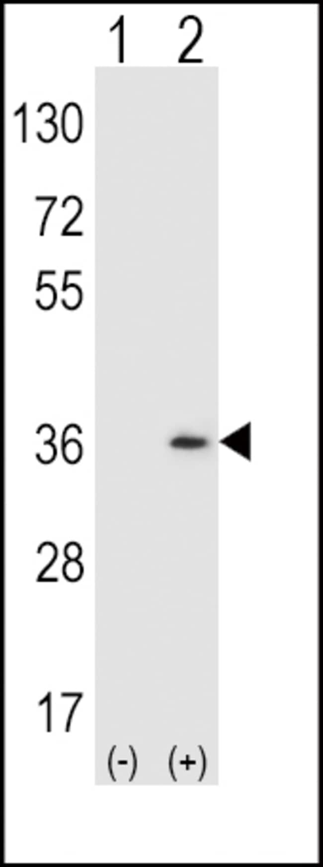 ANTI-SULT1A1, 0,1 MG