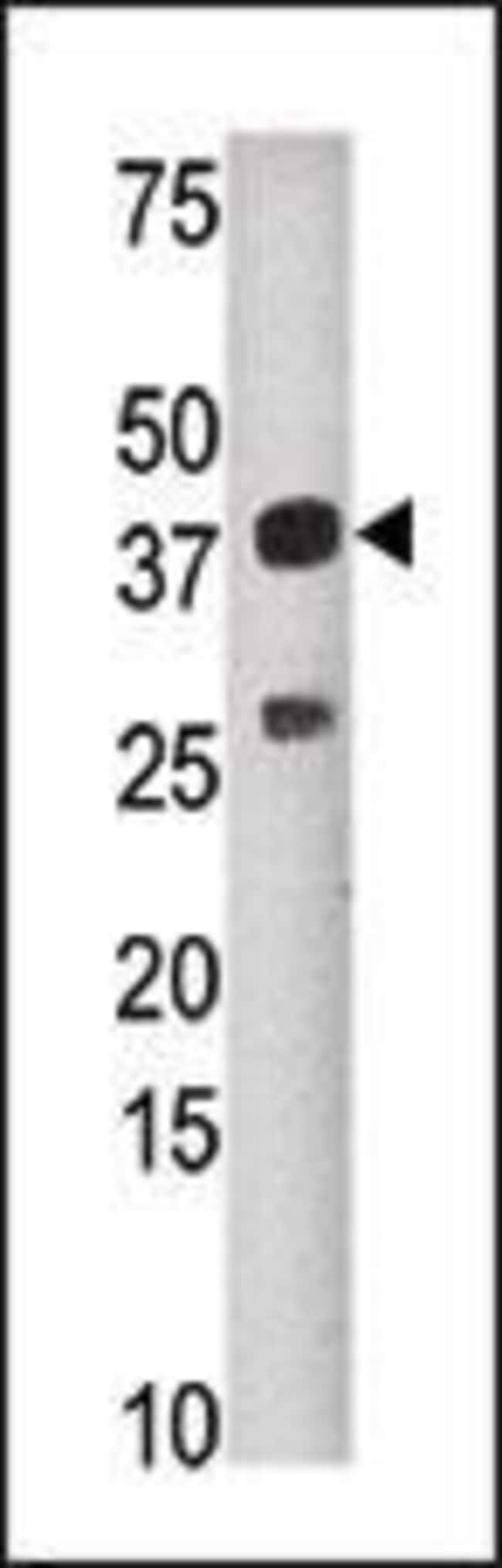 ANTI-SULT1C2, 0,1 MG