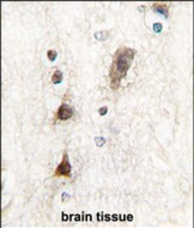 ANTI-PTF1A, 0,1mg .