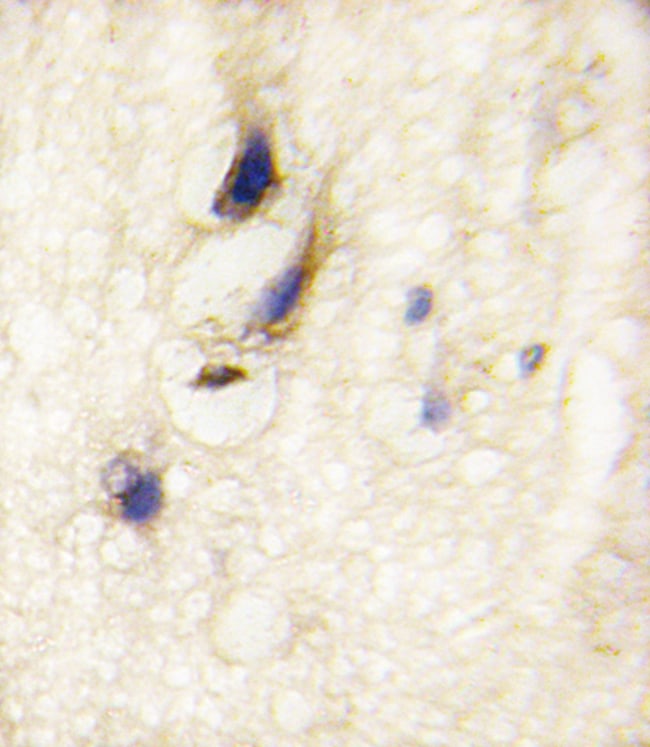 ANTI-DAAM1, 0,1mg .