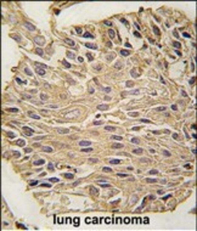 ANTI-ALDOA, 0,1 MG