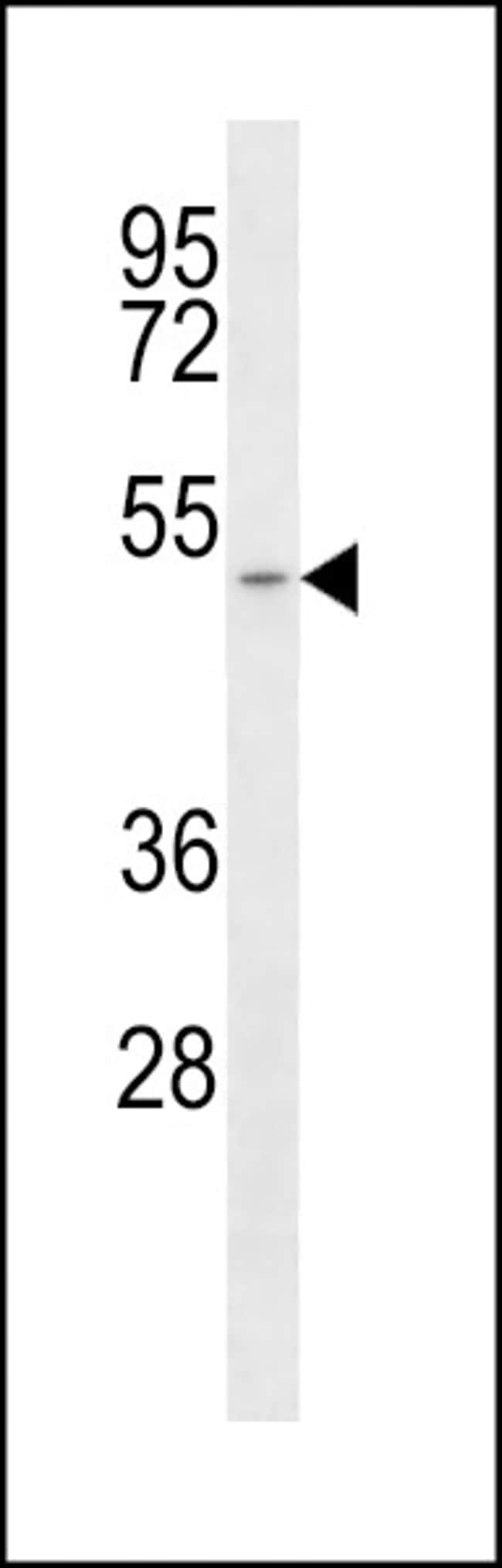 ANTI-MCT1, 0,1 MG