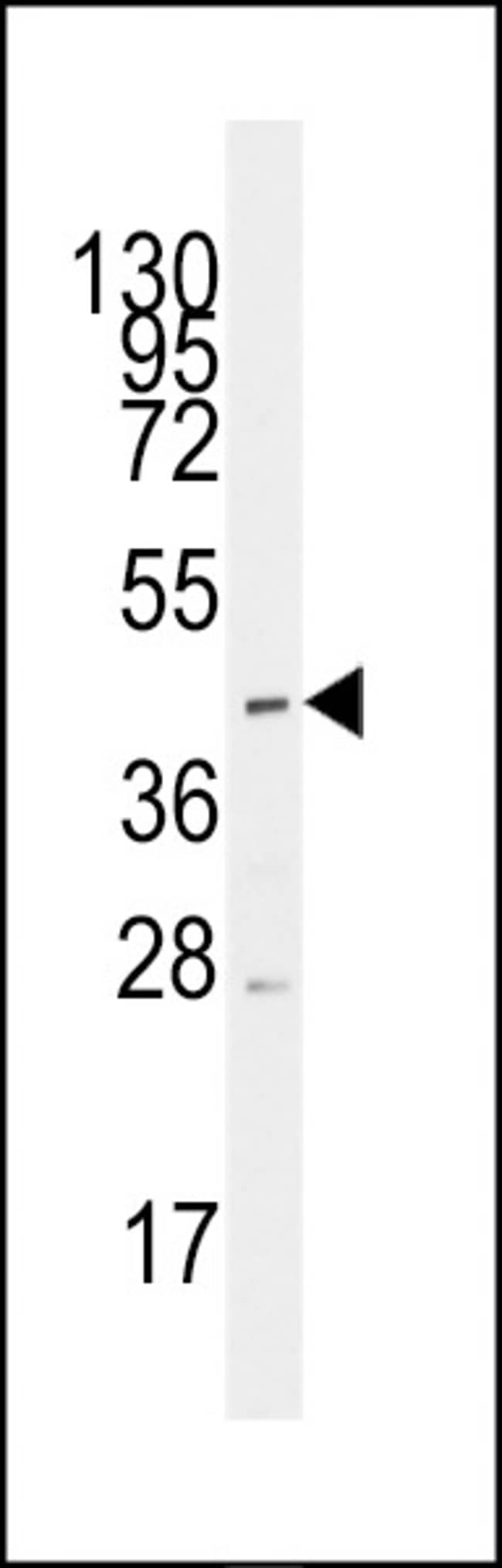 ANTI-MCT1, 0,1 MG