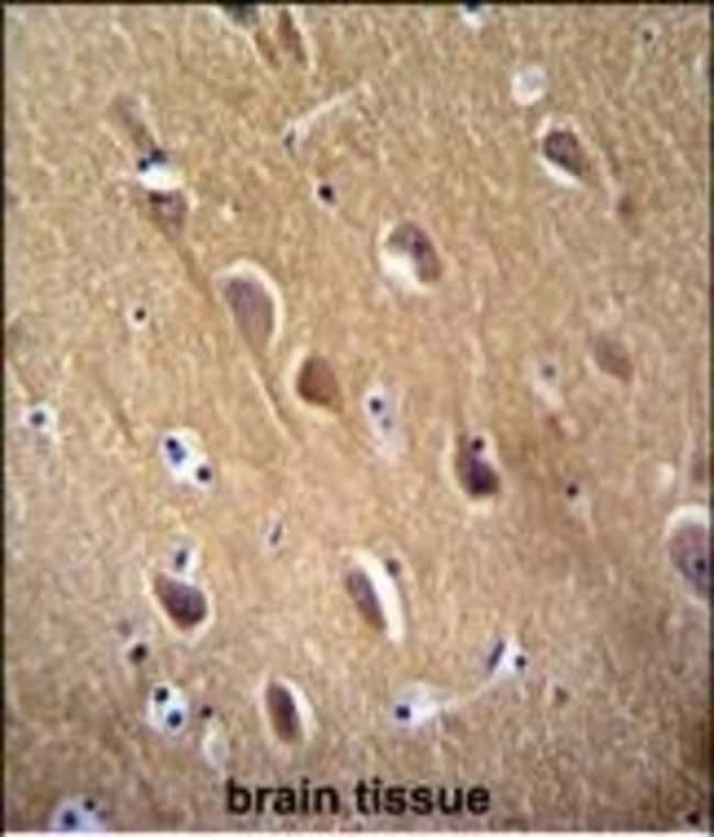 ANTI-NSE, 0,1 MG