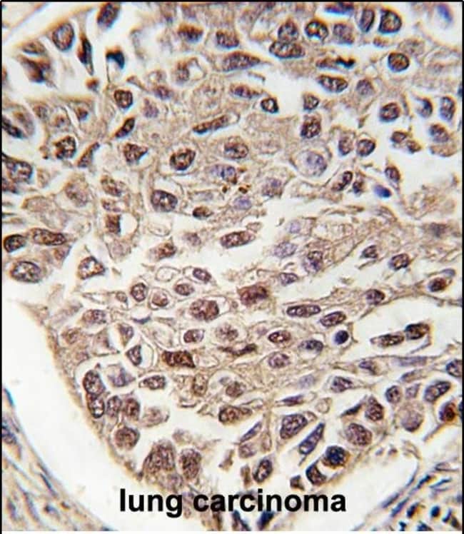 ANTI-SFRS2, 0,1 MG
