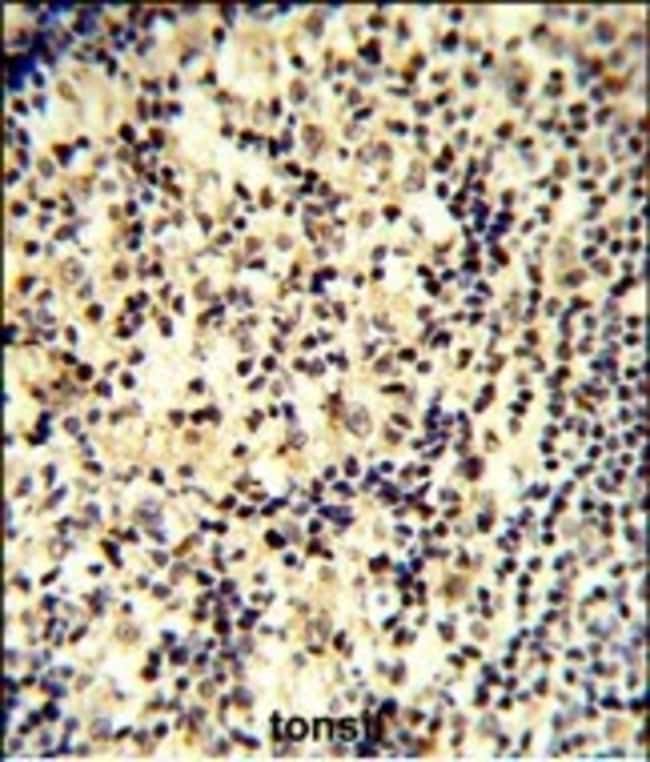 ANTI-SNRPD1, 0,1 MG
