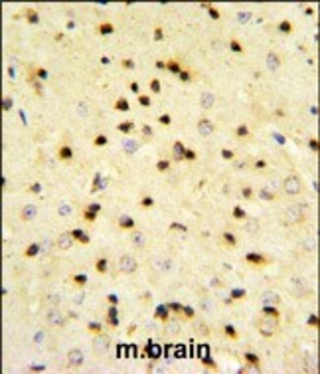 ANTI-EBP1, 0,1mg .
