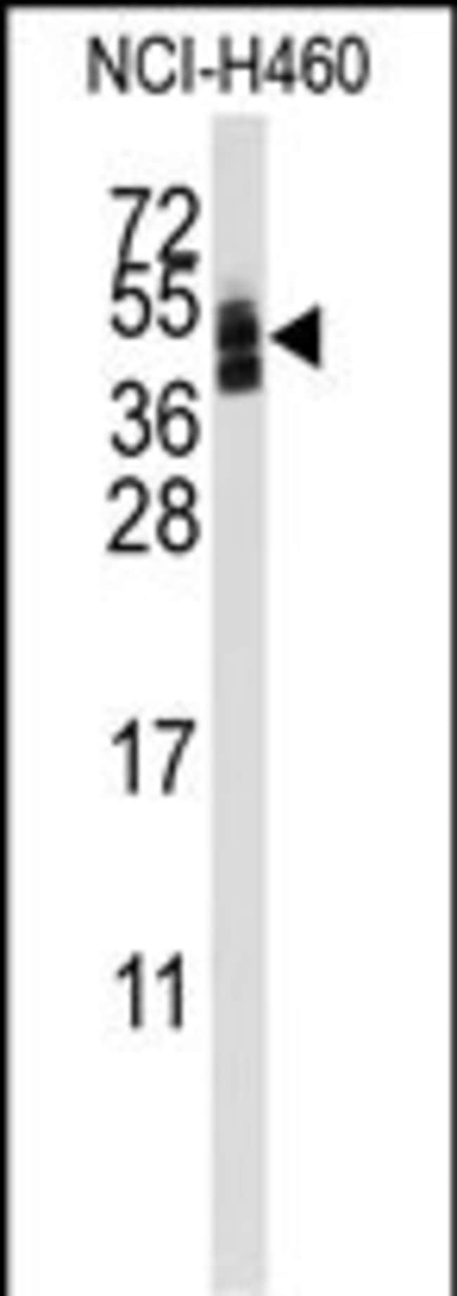 ANTI-CXADR, 0,1 MG