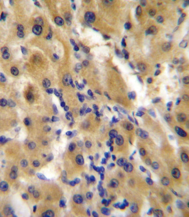 ANTI-ENPP2, 0,1 MG
