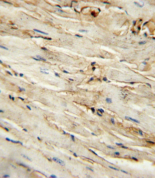 100 µG ANTI-CD105 .