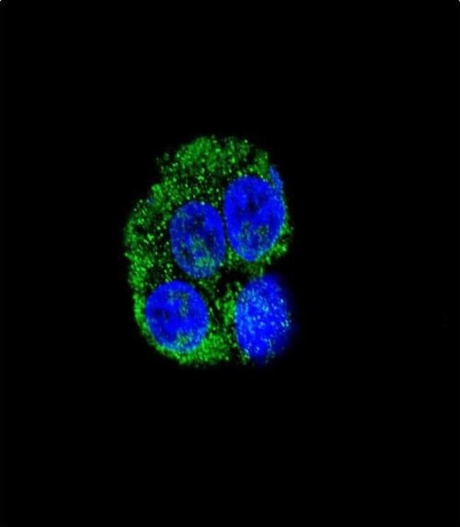 ANTI-CD36, 0,1 MG