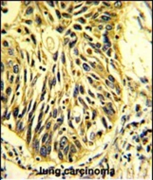 ANTI-CD201, 0,1mg .
