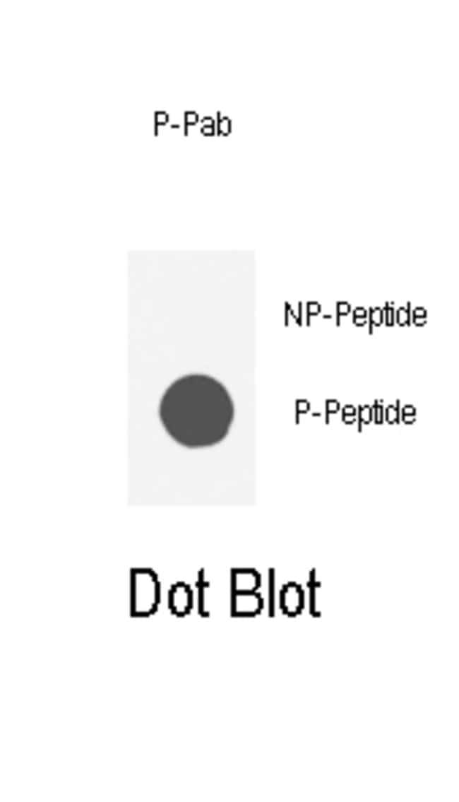 100UG ANTI-PHOSPHO-AKT1-S129 .