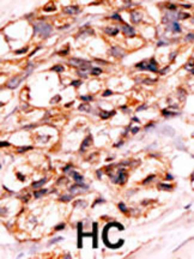 ANTI-PHOSPHO-BAD-S118, 0,1mg .