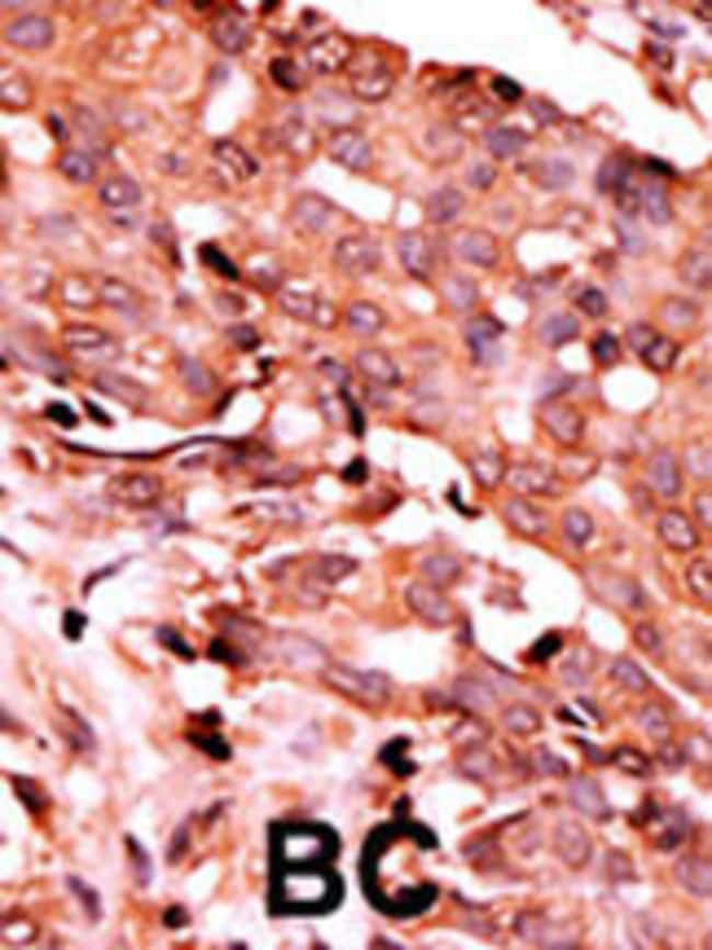 Anti-Phospho-Caspase 6-S257 0.1 mg