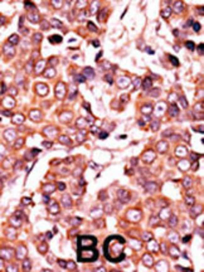 Anti-Phospho-CDC25A-S278 0.1 mg MG