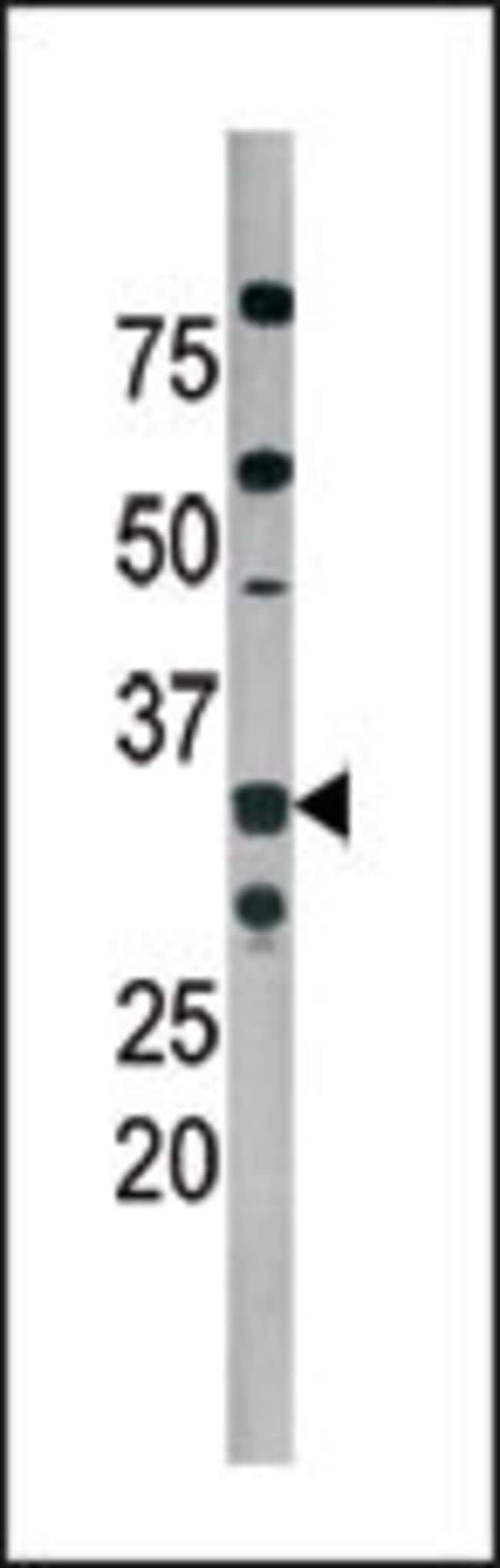 ANTI-PHOSPHO-CDK2-T160, 0,1 MG
