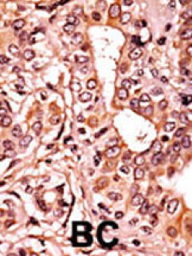 ANTI-PHOSPHO-CDK7-T170, 0,1 MG