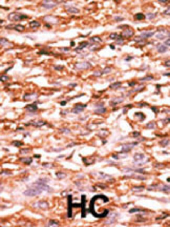 Anti-Phospho-KDR/FLK1-Y996 0.1 mg MG