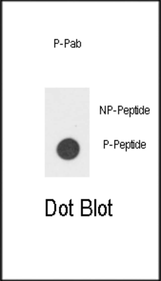 100UG ANTI-PHOSPHO-IL3R-Y766 .
