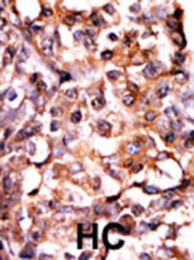 Anti-Phospho-MAPKAPK2-S272 0.1 mg MG